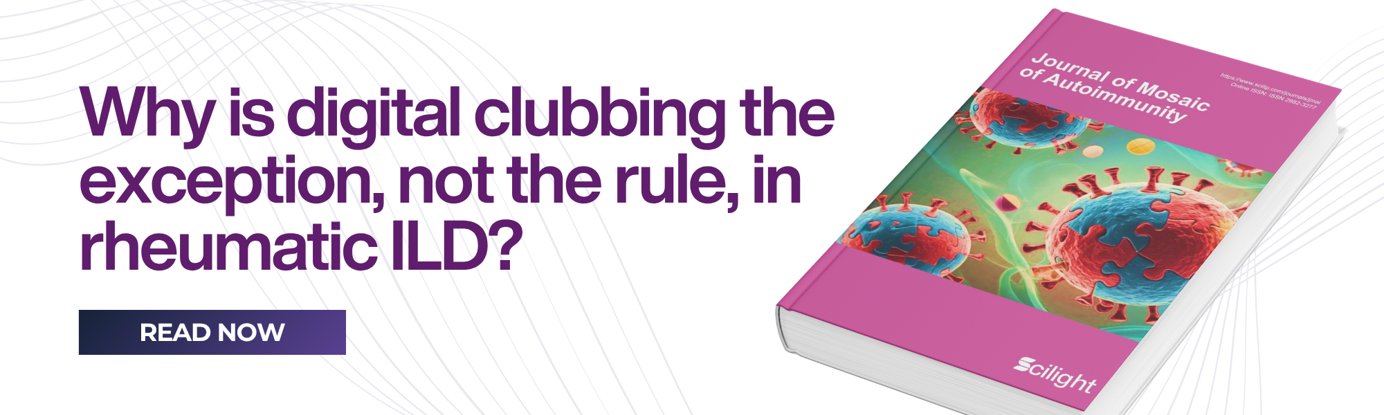 Why Do Rheumatic Diseases with Pulmonary Fibrosis Rarely Develop Digital Clubbing?